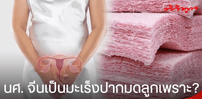 นักศึกษาเป็น "มะเร็งปากมดลูก" เพราะกระดาษชำระที่ใช้อยู่