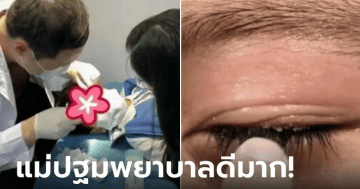กาวน้ำเข้าตา