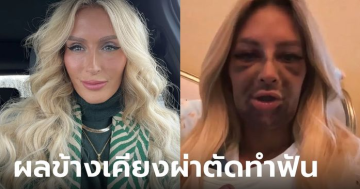 สาวผ่าตัดรากฟันเทียม