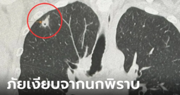 สะพรึง หญิงชอบให้อาหารนกพิราบ