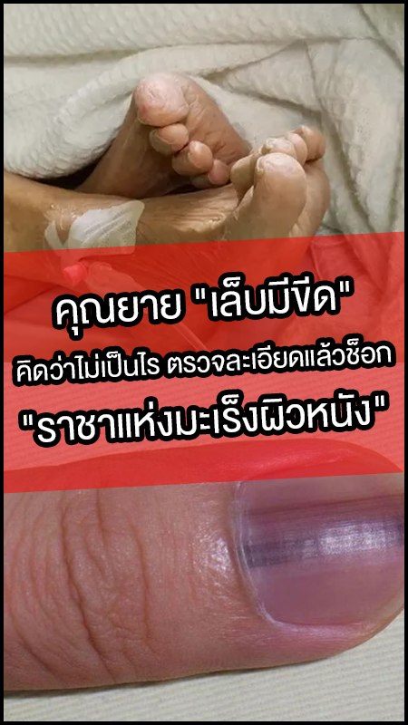 คุณยาย เล็บมีขีด