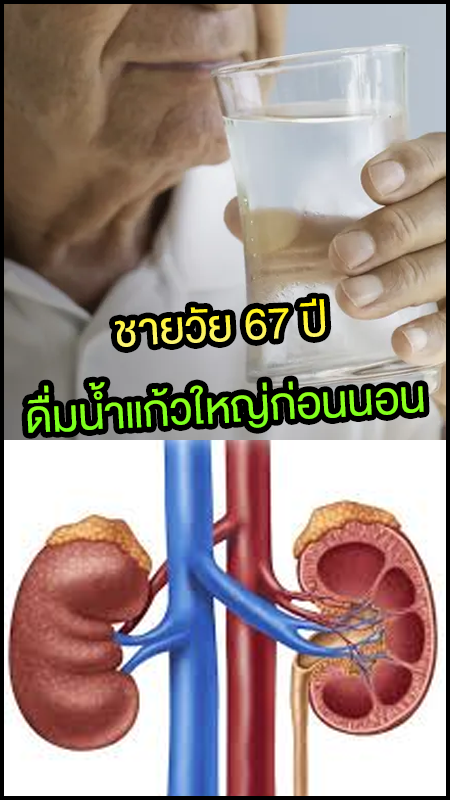 ชายวัย 67 ดื่มน้ำแก้วใหญ่ก่อนนอน 2 ชม. ผ่านไปครึ่งปีไปหาหมอ ได้ผลลัพธ์ที่ไม่คาดคิด